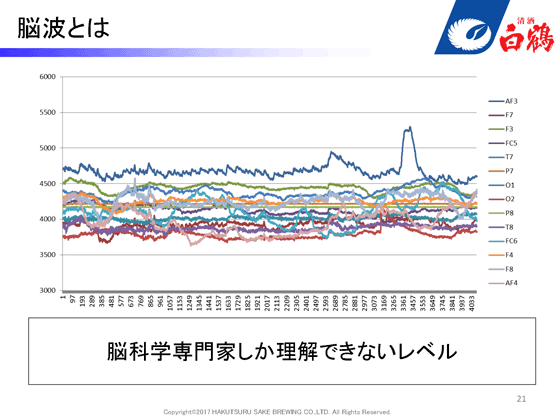 脳波とは